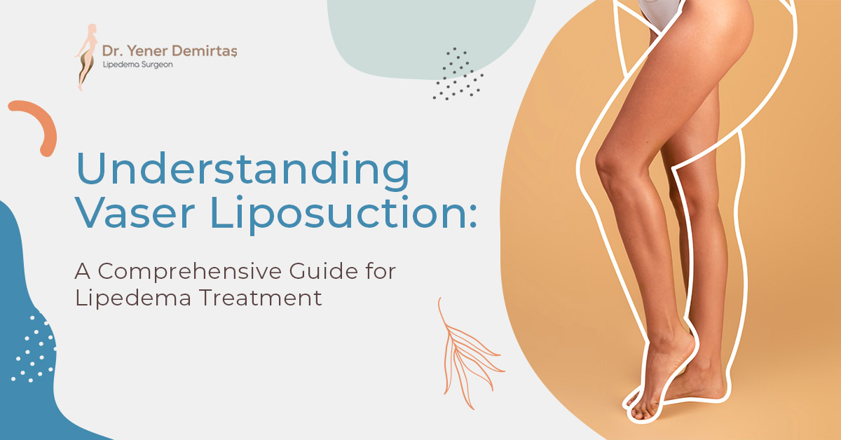 Understanding Vaser Liposuction: A Comprehensive Guide for Lipedema  Treatment