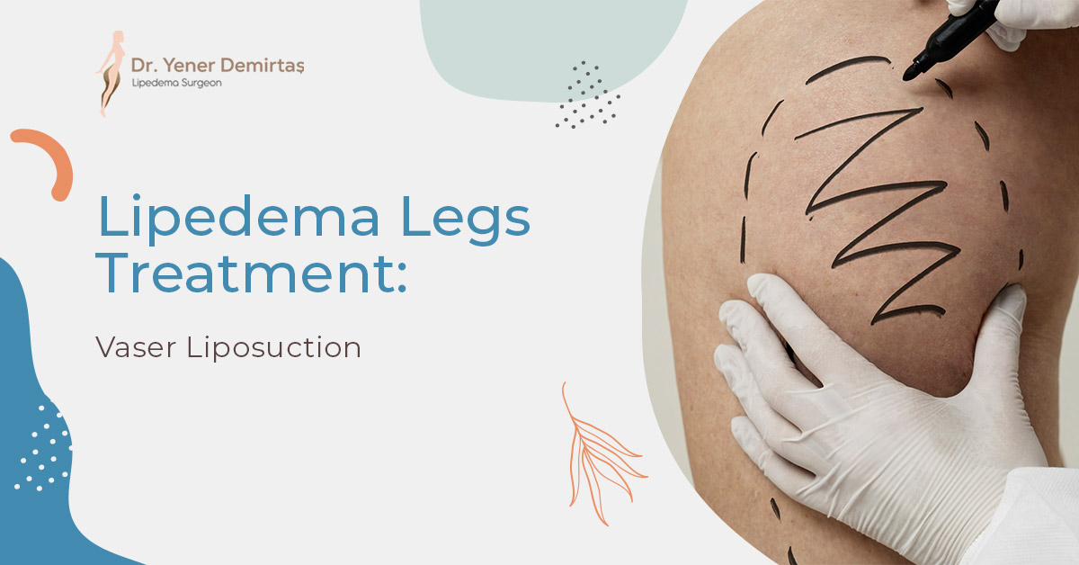 Lipedema Legs Treatment: Vaser Liposuction