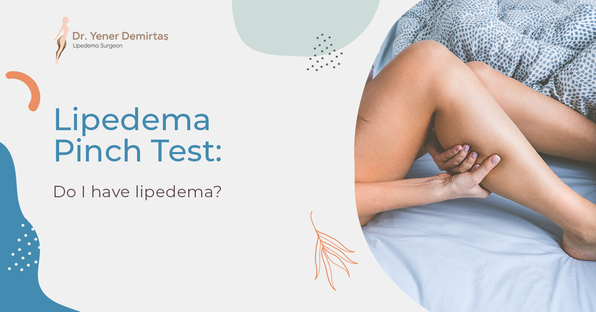 Lipedema Pinch Test: Do I Have Lipedema?